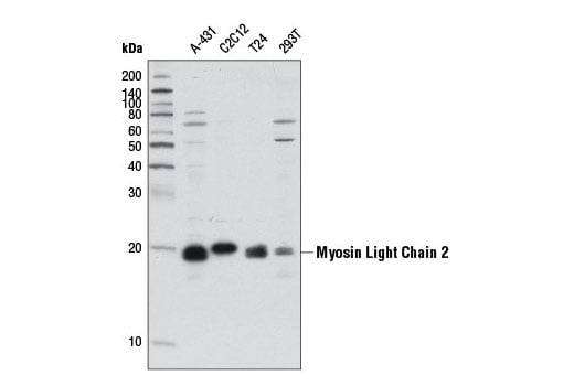 PhosphoPlus Myosin Light Chain 2 Thr18 Ser19 Antibody Duet Cell