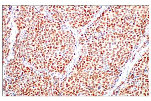  Image 20: Small Cell Lung Cancer Biomarker Antibody Sampler Kit