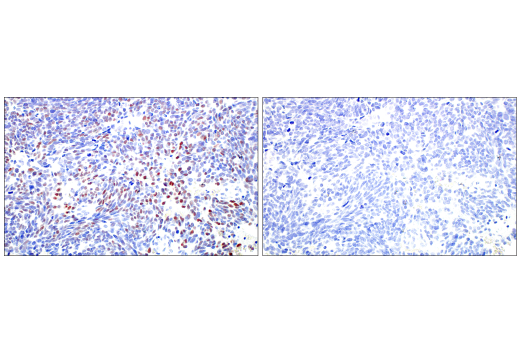 Immunohistochemistry Image 6: ASCL1 (E5S4Q) XP® Rabbit mAb