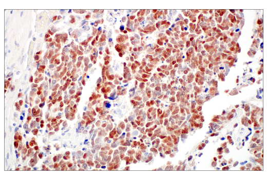  Image 41: Small Cell Lung Cancer Biomarker Antibody Sampler Kit