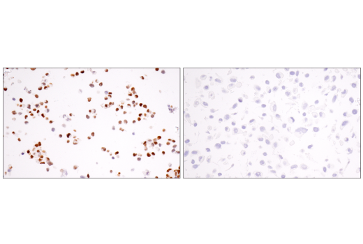  Image 58: Small Cell Lung Cancer Biomarker Antibody Sampler Kit