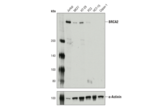  Image 2: Homologous Recombination (HR) DNA Repair Antibody Sampler Kit