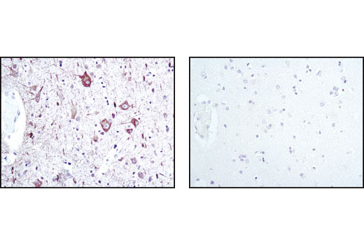 Immunohistochemistry Image 1: Neurofilament-L (C28E10) Rabbit mAb (BSA and Azide Free)