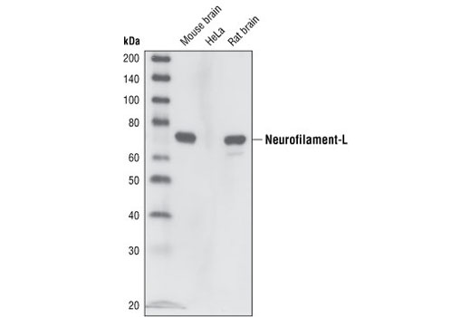 Western Blotting Image 1: Neurofilament-L (C28E10) Rabbit mAb (BSA and Azide Free)