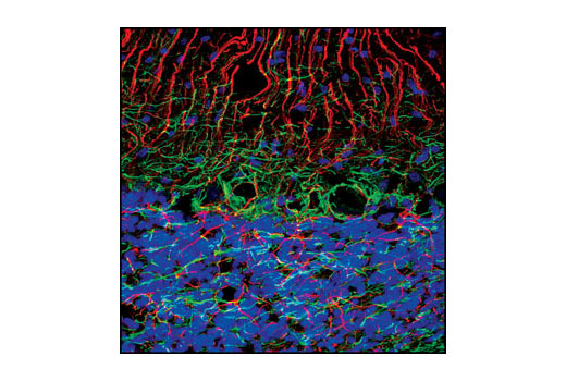Immunofluorescence Image 1: Neurofilament-L (C28E10) Rabbit mAb (BSA and Azide Free)