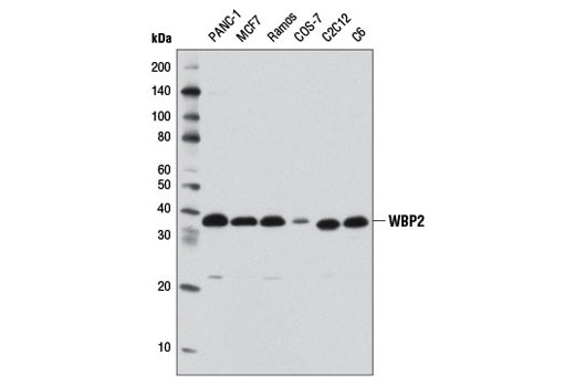 Western Blotting Image 1: WBP2 Antibody