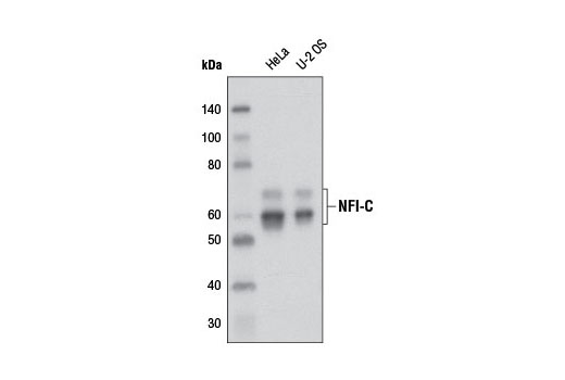 Western Blotting Image 1: NFI-C Antibody