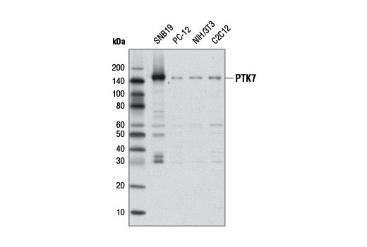 Western Blotting Image 1: PTK7 Antibody