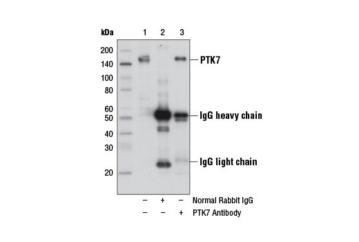 Immunoprecipitation Image 1: PTK7 Antibody