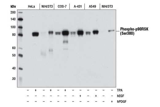  Image 1: p90RSK Antibody Sampler Kit