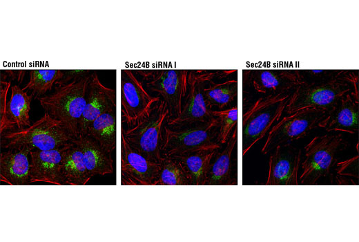 Immunofluorescence Image 1: Sec24B (D7D6S) Rabbit mAb