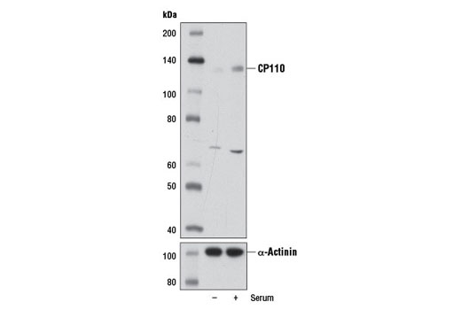 Western Blotting Image 2: CP110 Antibody