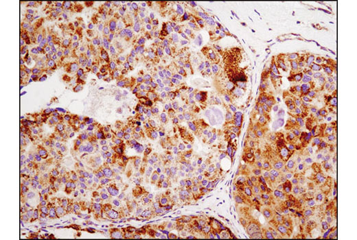  Image 20: Mitochondrial Marker Antibody Sampler Kit