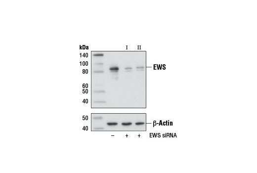  Image 1: SignalSilence® EWS siRNA II