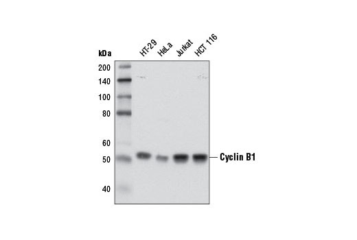 Image 3: Cell Cycle Regulation Antibody Sampler Kit II