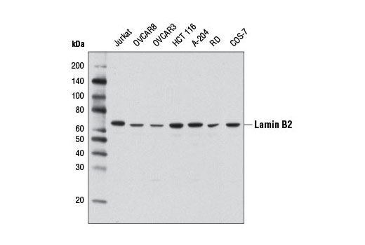 Western Blotting Image 1: Lamin B2 (D8P3U) Rabbit mAb