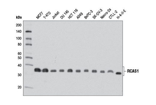  Image 3: ER and Golgi-Associated Marker Proteins Antibody Sampler Kit