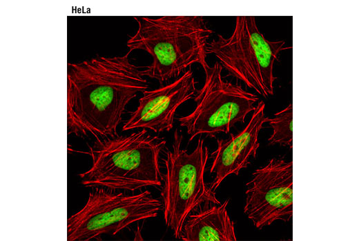  Image 12: Acetyl-Histone Antibody Sampler Kit