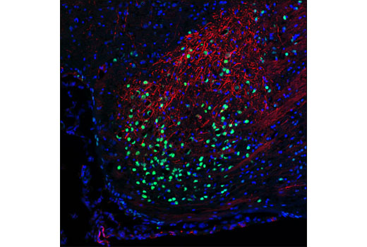 Immunofluorescence Image 1: Thyroid Transcription Factor 1 (TTF-1) (D2E8) Rabbit mAb