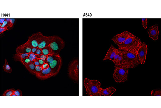  Image 32: Small Cell Lung Cancer Biomarker Antibody Sampler Kit