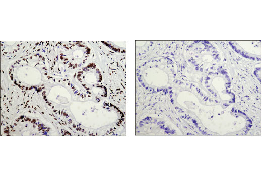 Immunohistochemistry Image 1: AUF1/hnRNP D (D6O4F) Rabbit mAb