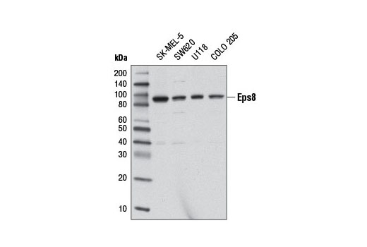 Western Blotting Image 1: Eps8 Antibody