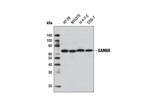 Western Blotting Image 1: SAM68 Antibody