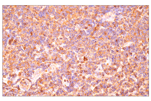 Immunohistochemistry Image 1: NF-κB1 p105/p50 (D7H5M) Rabbit mAb