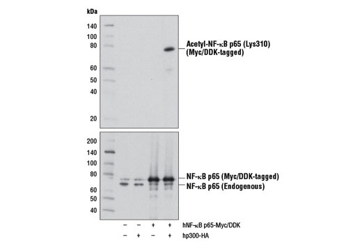 Western Blotting Image 1: Acetyl-NF-κB p65 (Lys310) (D2S3J) Rabbit mAb