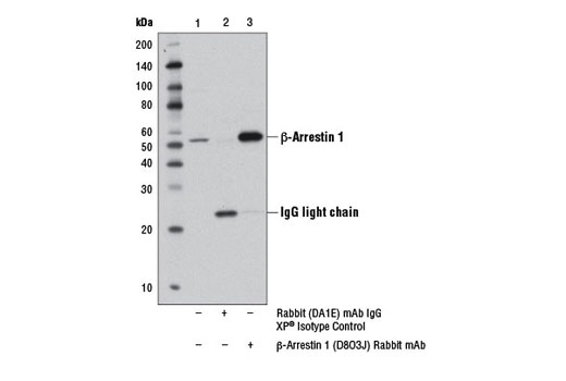Immunoprecipitation Image 1: β-Arrestin 1 (D8O3J) Rabbit mAb