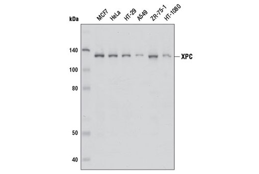 Western Blotting Image 1: XPC Antibody