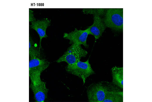 Immunofluorescence Image 1: uPAR (D7X2N) Rabbit mAb