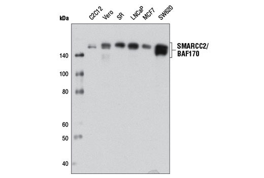  Image 8: BAF Complex Antibody Sampler Kit