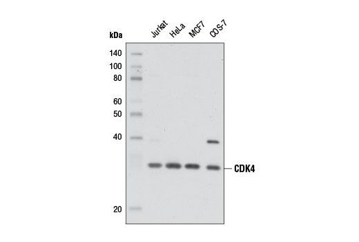  Image 6: CDK Antibody Sampler Kit