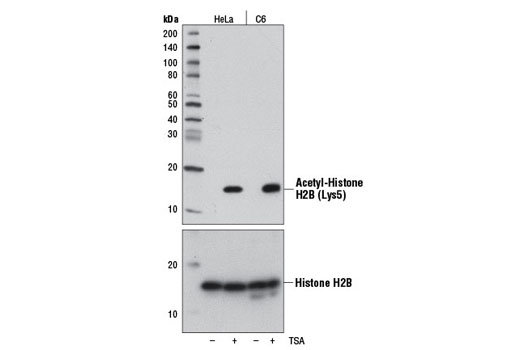  Image 3: Acetyl-Histone Antibody Sampler Kit