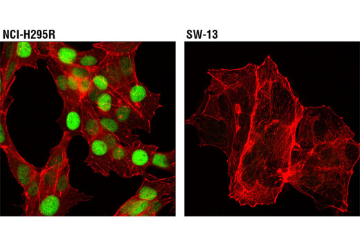 Immunofluorescence Image 1: STF-1 (D1Z2A) XP® Rabbit mAb