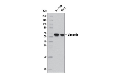 Western Blotting Image 1: Vimentin (D21H3) XP® Rabbit mAb (HRP Conjugate)