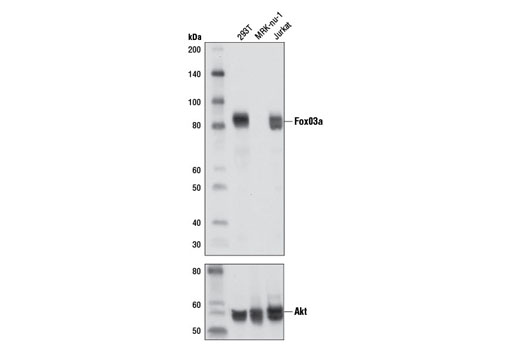  Image 2: Forkhead Signaling Antibody Sampler Kit