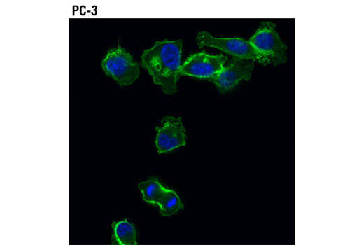 Immunofluorescence Image 1: Merlin (D3S3W) Rabbit mAb