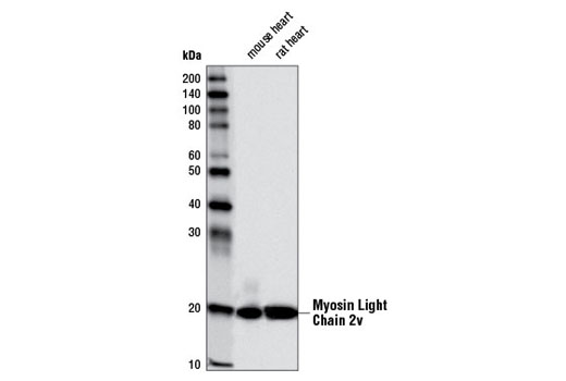 Western Blotting Image 1: Myosin Light Chain 2v (D5I1C) (Cardiac Isoform) Rabbit mAb