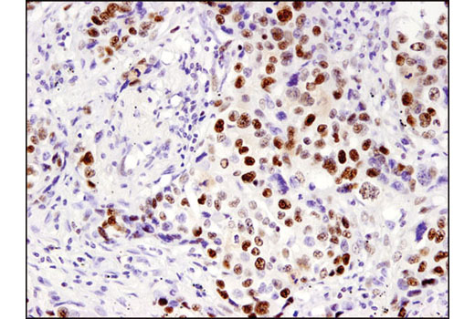 Immunohistochemistry Image 2: MSH6 (3E1) Mouse mAb