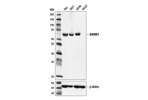 Western Blotting Image 1: SARM1 (D2M5I) Rabbit mAb