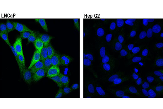 Immunofluorescence Image 1: PFKFB2 (D5I5F) Rabbit mAb