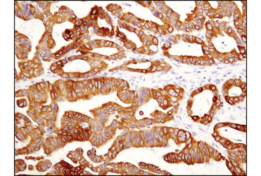 Immunohistochemistry Image 1: Keratin 19 (D7F7W) Rabbit mAb