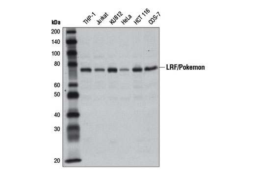 Western Blotting Image 1: LRF/Pokemon Antibody