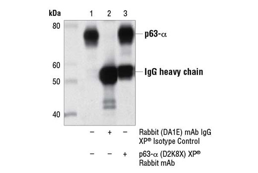 Immunoprecipitation Image 1: p63-α (D2K8X) XP® Rabbit mAb