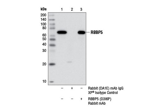  Image 11: Lysine Methyltransferase Antibody Sampler Kit