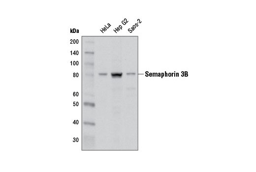 Western Blotting Image 1: Semaphorin 3B (D5A2P) Rabbit mAb