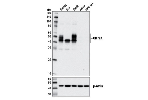  Image 6: B Cell Signaling Antibody Sampler Kit II