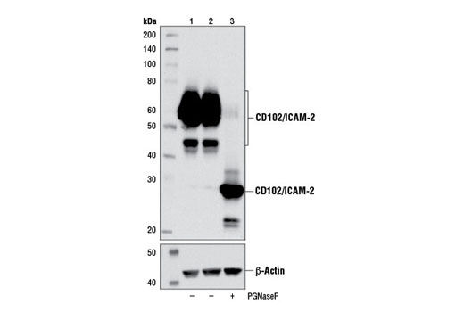 Western Blotting Image 2: CD102/ICAM-2 (D7P2Q) Rabbit mAb